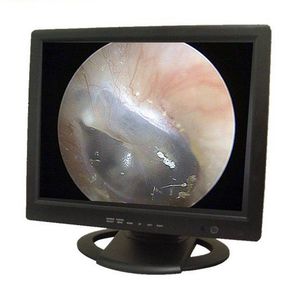 monitor per endoscopia