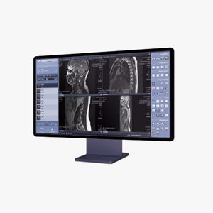 PACS per diagnostica per immagini