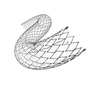 stent arteria iliaca