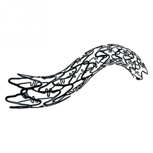 stent periferico 1