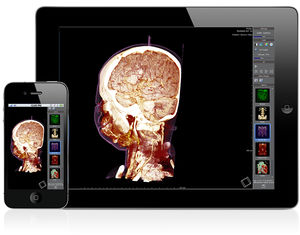 software di condivisione / di visualizzazione / per diagnostica per immagini