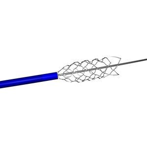 stent in titanio 1