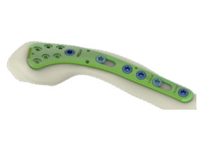 placca di compressione per clavicola
