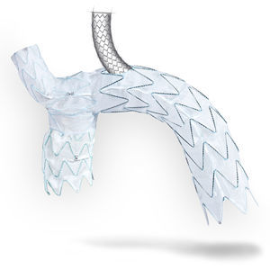 innesto stent per arco aortico