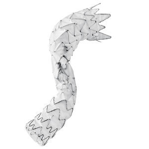 innesto stent di aorta toracica