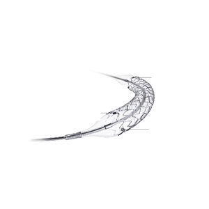 stent coronarico