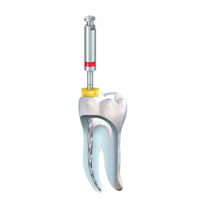 lima endodontica rotativa