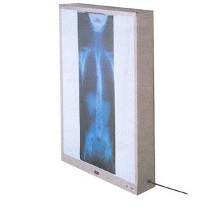negativoscopio 1 corpo