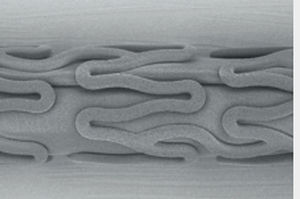 stent coronarico 1