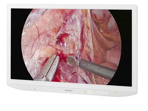 monitor chirurgico