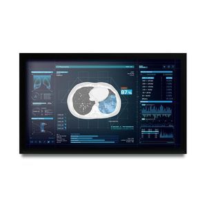 monitor medico 1