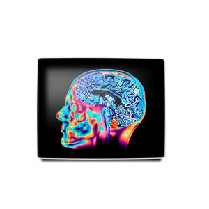 monitor medico