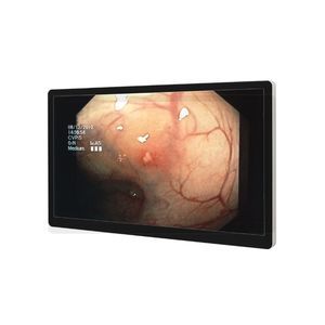 monitor per endoscopia