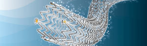 stent periferico