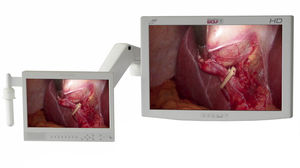 monitor per endoscopia