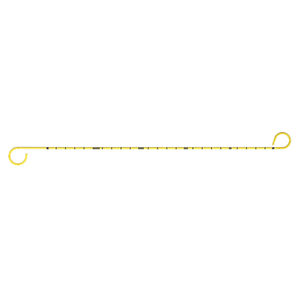stent ureterale