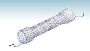 stent esofageo 1