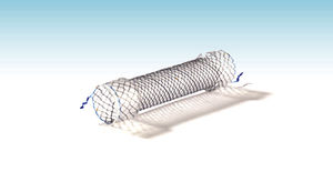 stent esofageo 1