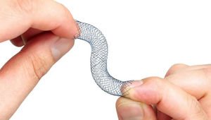 stent duodenale 1