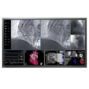 monitor diagnostico