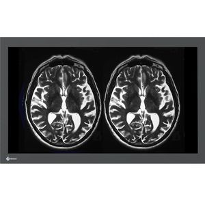 monitor medico 1