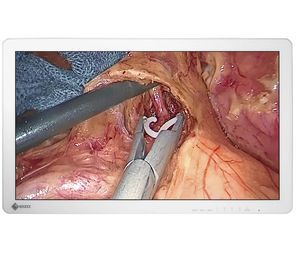 monitor per endoscopia 1