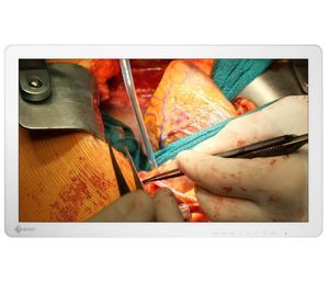 monitor per endoscopia 1