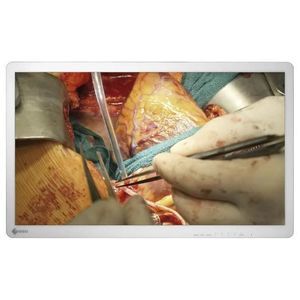 monitor per endoscopia 1