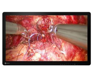 monitor per endoscopia 1