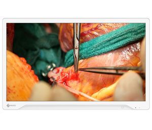 monitor per endoscopia 1