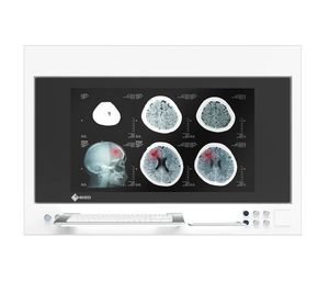 monitor chirurgico 1