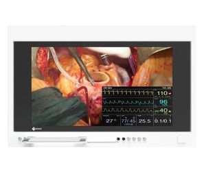 monitor chirurgico 1