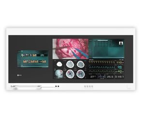 monitor per diagnostica per immagini 1