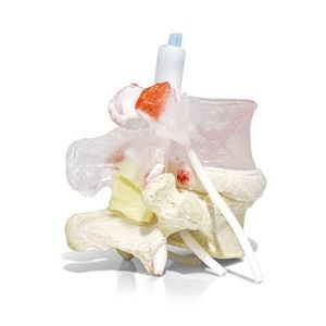 modello anatomico di dischi intervertebrali