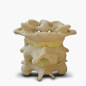 modello anatomico di rachide 1