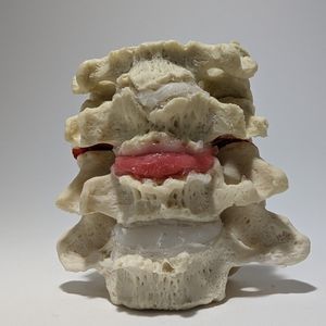 modello anatomico di dischi intervertebrali