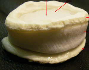 modello anatomico di dischi intervertebrali 1
