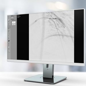 software di ottimizzazione delle immagini