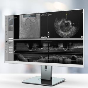 software di visualizzazione 1