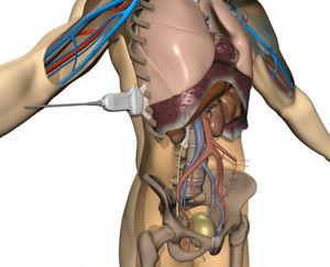 simulatore di paziente per cure cliniche