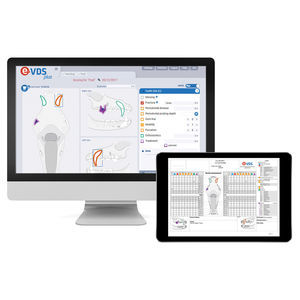 software di trattamento