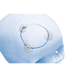 sistema di fissazione cranica assorbibile 1