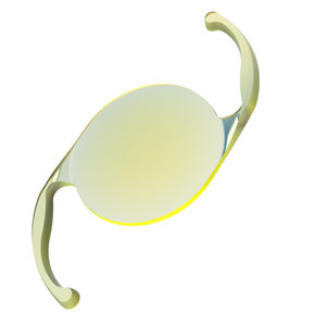 lente intraoculare monofocale 1