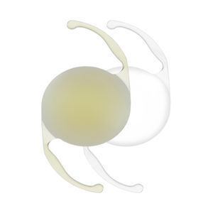 lente intraoculare monofocale 1