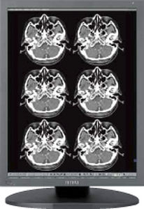 monitor per diagnostica per immagini