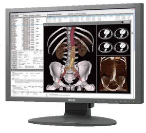 monitor per diagnostica per immagini