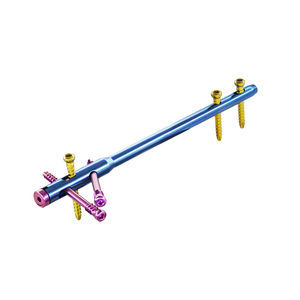 chiodo intramidollare per tibia
