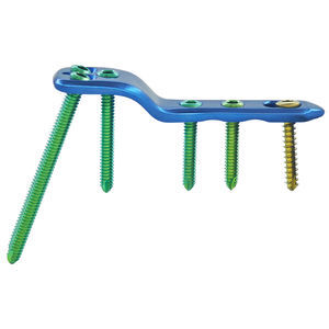 placca per osteotomia per femore 1
