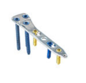 placca per osteotomia per tibia 1
