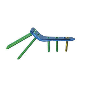 placca per osteotomia per femore 1